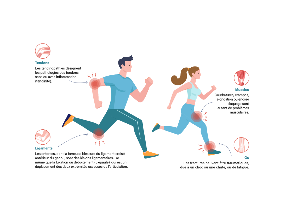 Illustration tendons, ligaments, os et muscles